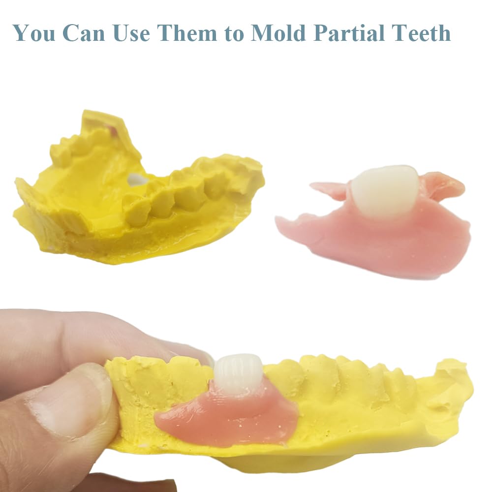 DIY Denture Complete Kit with Impression Material, Gum Material, Components for Top and Bottom Full or Partial Dentures N1304